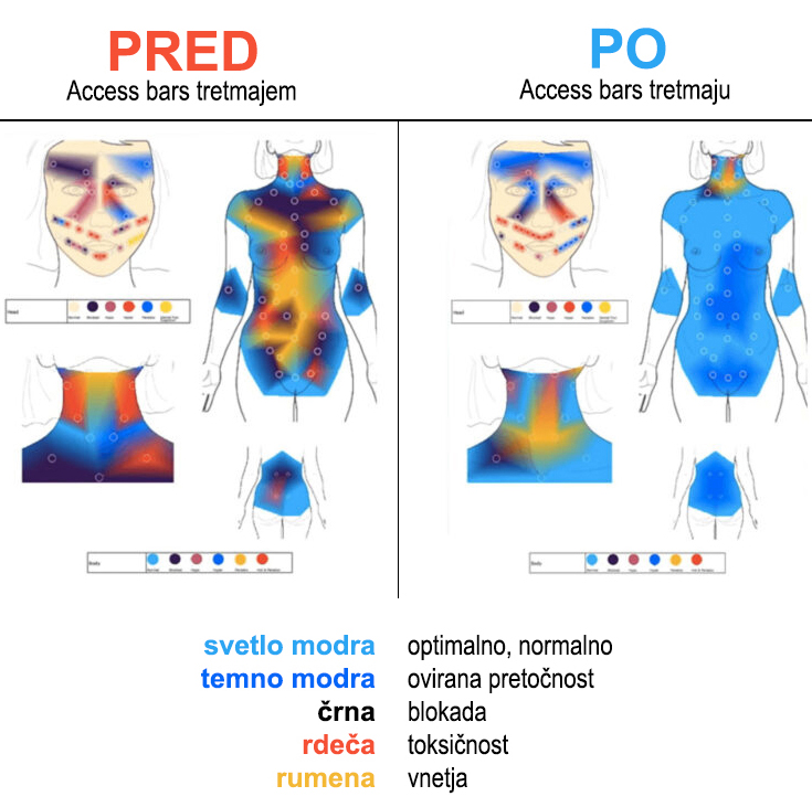access bars termomitrija